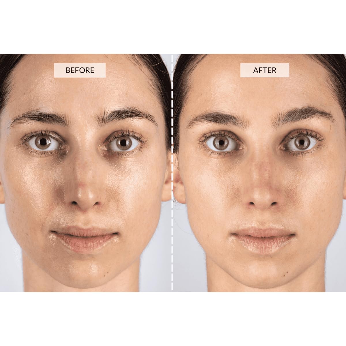 LED Pro Skin Therapy Mask