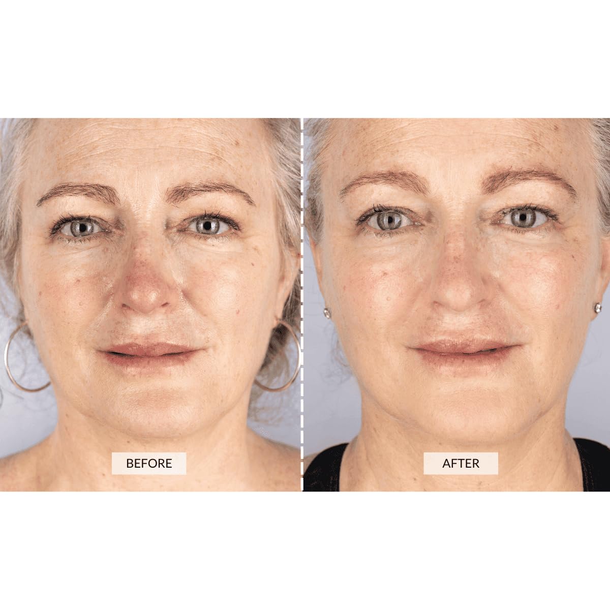 LED Pro Skin Therapy Mask