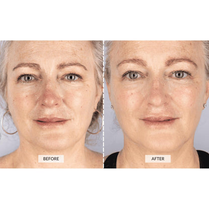 LED Pro Skin Therapy Mask